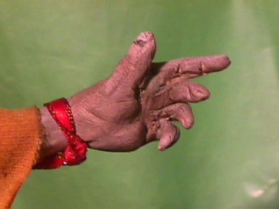 The hand 